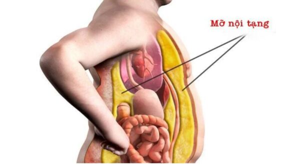 3 Bộ Môn Yoga Giảm Mỡ Toàn Thân Cho Người Mới Tập UP GYM - Hệ Thống Lớp Tập Giảm Cân Chuẩn Khoa Học